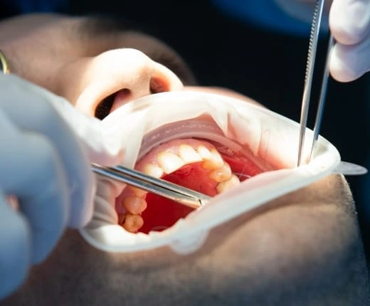 checkup dental servicio endodoncia