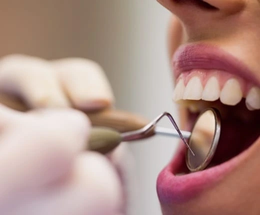 checkup dental servicio general
